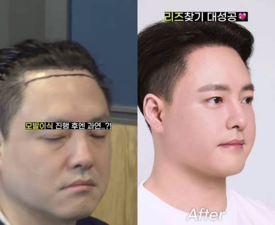 노유민이 모발이식에 이어 눈 밑 지방재배치 시술로 전성기 비주얼을 되찾았다. 노유민 인스타그램 갈무리