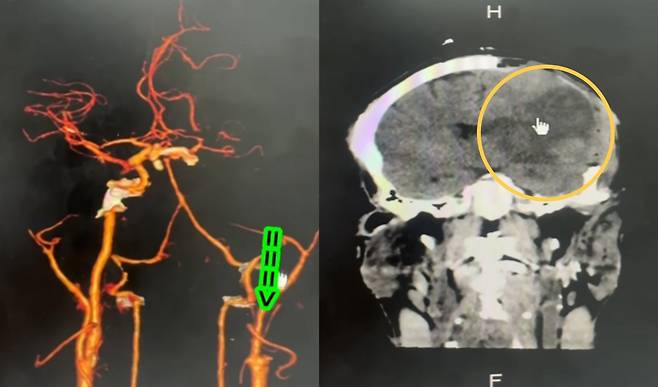 사진=프라차 페이스북.