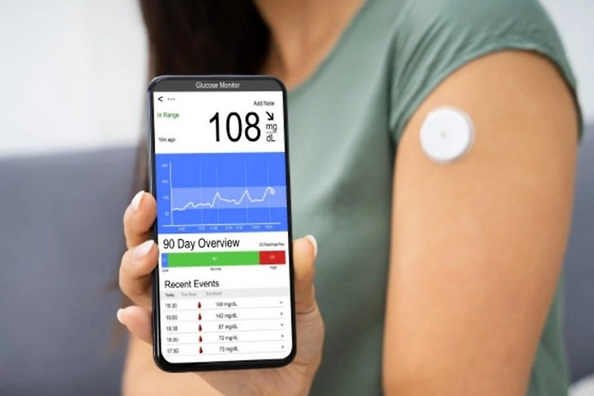 연속 혈당측정기