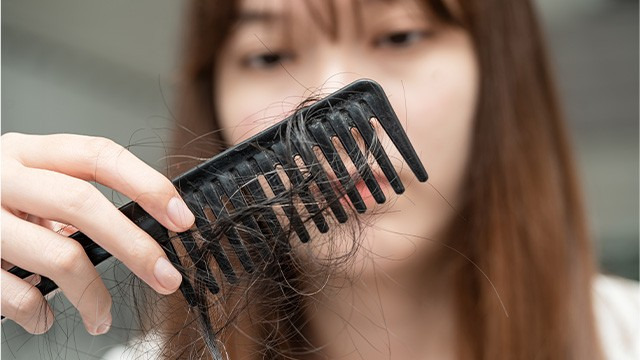 ﻿생활 습관을 바꾸면 탈모를 효과적으로 예방, 관리할 수 있다｜출처: 게티이미지뱅크
