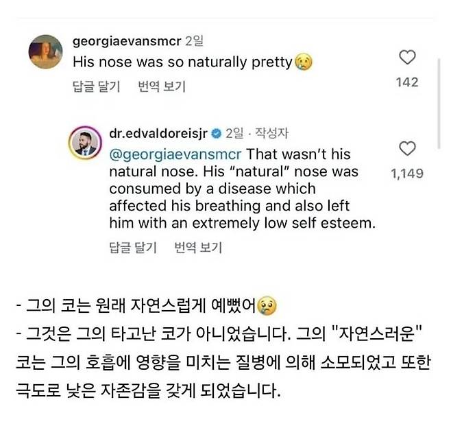 696D150D-4B0C-4807-B4F2-1AC22375065D.jpeg 레전드 코 성형수술. jpg