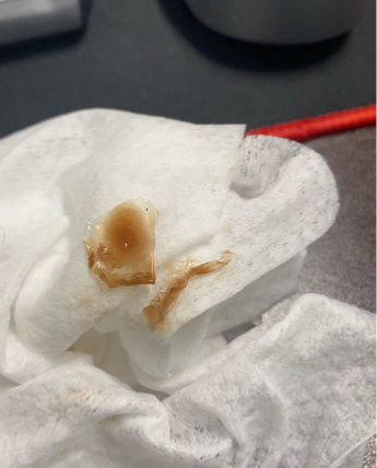 한 온라인 커뮤니티에서 이용자가 단백질 음료 속 덩어리 사진을 올렸다. [사진 = 온라인 커뮤니티 캡처]