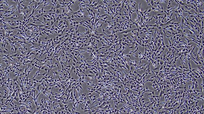 국내 공동 연구팀이 생산한 동종 배아줄기세포 유래 중간엽줄기세포(MMSC)를 현미경으로 확대한 모습 (제주대학교 제공)