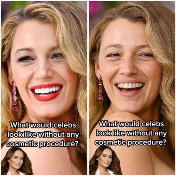 두바이의 한 피부미용전문가 마리나 폴타가 자연미로 알려진 할리우드 여성 스타들의 외모가 사실은 고급 미용 시술의 결과일 수 있다고 주장했다./사진=마리나 폴타 인스타그램 캡처