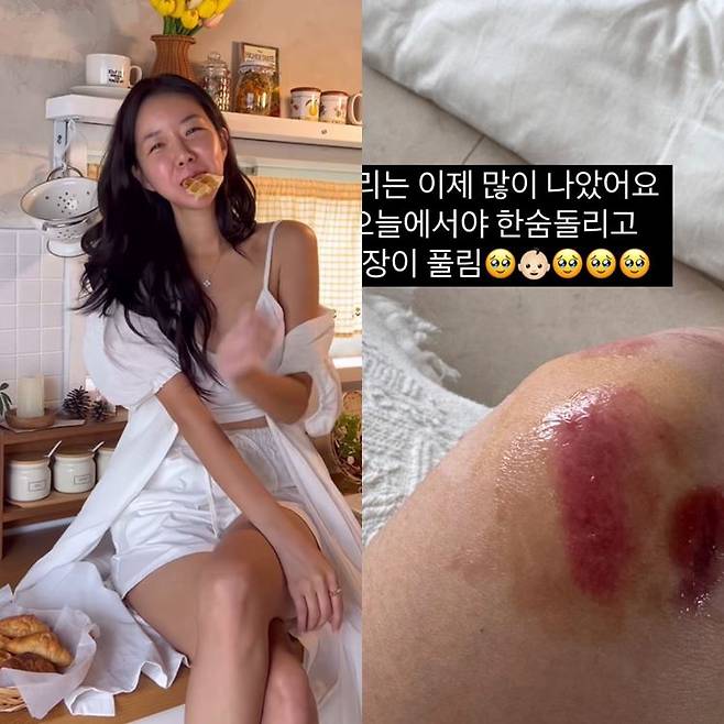 사진=김지혜 SNS.