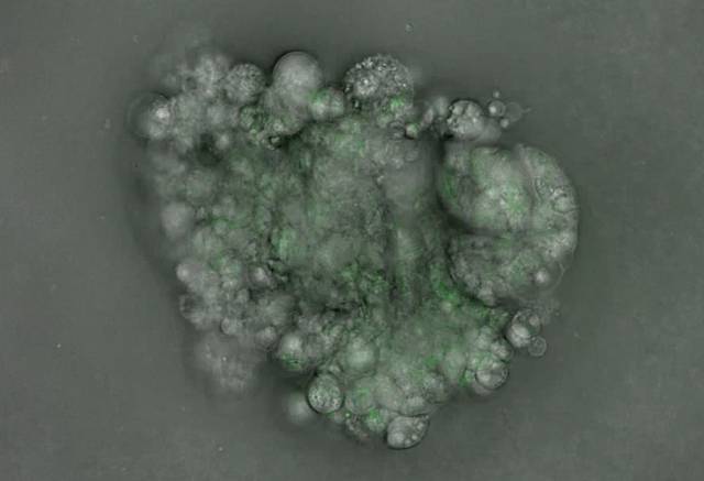 인플루엔자 바이러스 'PR8-GFP'에 감염된 문둥이박쥐의 소장 오가노이드 모습. 사진 제공=과학기술정보통신부