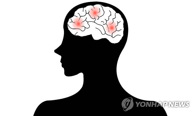 뇌졸중 뇌출혈(일러스트) 제작 박이란