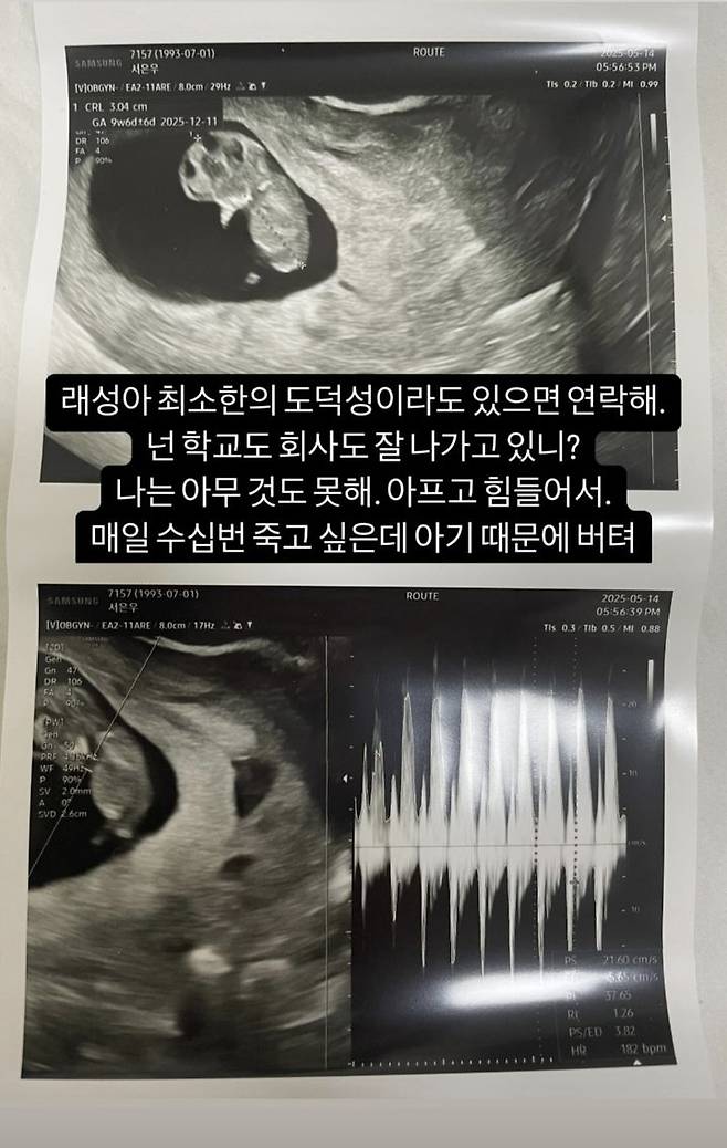 [서울=뉴시스] '하트시그널3' 출신 서은우(개명 전 서민재)가 남자친구에게 연락달라고 요청했다. (사진=서은우 인스타그램 캡처) 2025.05.17. photo@newsis.com *재판매 및 DB 금지