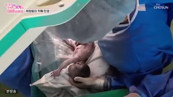 /사진=TV조선 '우리 아기가 태어났어요' 방송화면