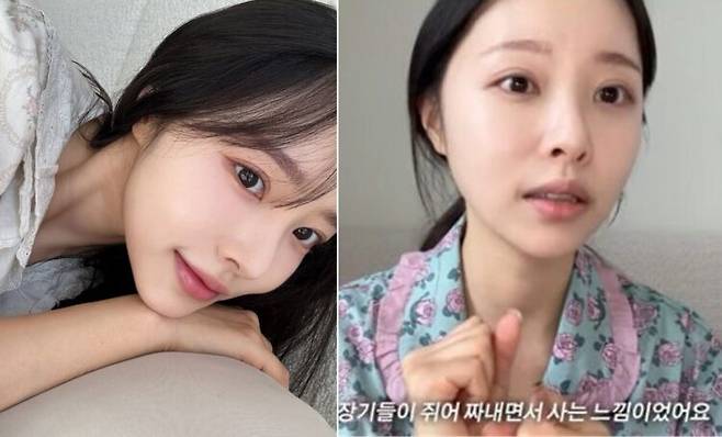 박성광 아내이자 인플루언서 이솔이(37)가 암 진단 전 겪은 전조증상을 공개했다. [사진=유튜브 채널 '이솔이 leesolyi']