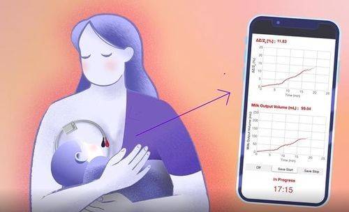 모유 수유 중 섭취량을 실시간으로 측정할 수 있는 무선 웨어러블 센서. 노스웨스턴대
