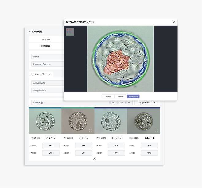 카이헬스에서 개발한 배아 분석 AI. 배아의 현미경 사진을 올리면, 1초 만에 배아 상태와 등급이 판별된다. /카이헬스