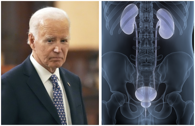 전립선암은 고령에서 많이 발생하고, 유전적 소인, 남성호르몬의 영향, 서구식 식이 습관 등이 원인으로 꼽힌다. 사진은 조 바이든 전 미국 대통령과 전립선 이미지. 연합뉴스, 게티이미지뱅크