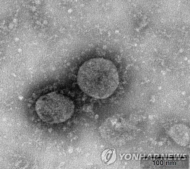 코로나19 바이러스의 전자현미경 사진 [EPA 연합뉴스 자료사진. 재판매 및 DB 금지]