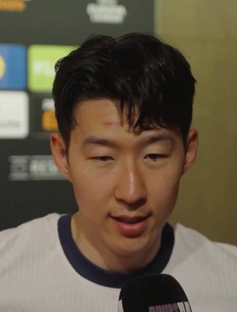 구단과 인터뷰하는 손흥민의 이마에 상처가 남아있다