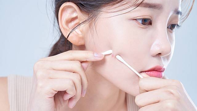 여드름은 털을 만드는 모낭에 붙어 있는 피지선에 발생하는 만성 염증성 질환이다｜출처: 클립아트코리아