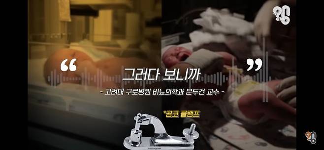 신생아 때 포경수술을 하면 작아진다