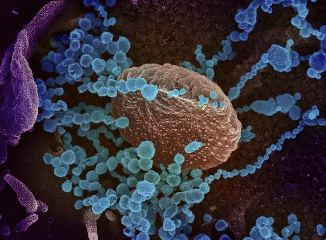 신종 코로나바이러스의 전자 현미경 이미지 [사진 = 연합뉴스]