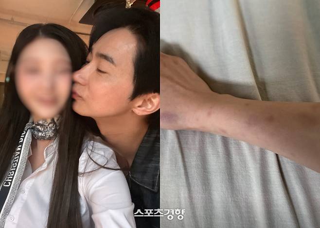 뮤지컬 배우 전호준의 연인 A씨가 폭행 및 금전 갈취 등을 폭로하고 나섰다. 본인 인스타그램 계정