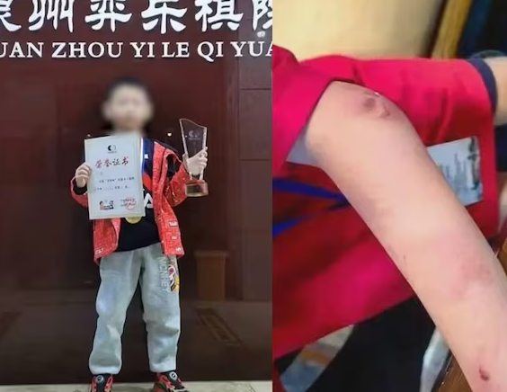 '바둑 신동'으로 알려진 중국의 9세 소년이 사망한 가운데, 그가 아버지에게 상습적으로 학대를 당해 극단적 시도를 했다는 의혹이 제기됐다.  사진=소후닷컴