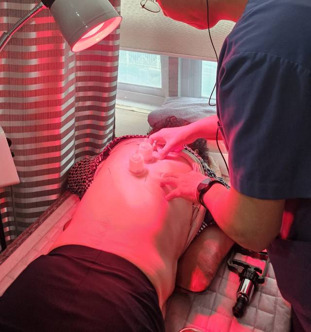 부항 치료 장면. 김해제중한의원 제공