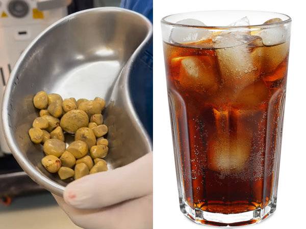 사진=비뇨기과 전문의 탈레스 안드라데 씨 인스타그램(왼쪽)과 게티이미지코리아.