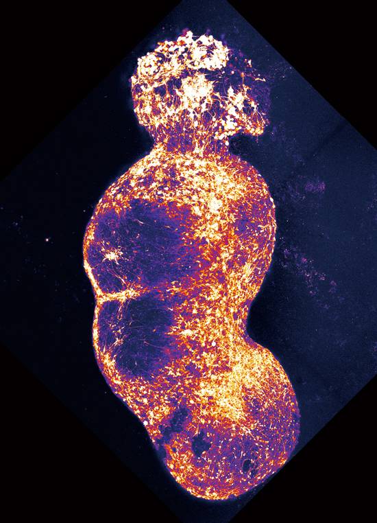 통증 전달 경로를 구현한 어셈블로이드. 감각신경세포 오가노이드가 맨 위에 있고, 그 아래로 차례대로 척수, 시상, 대뇌피질 오가노이드가 연결된 형태다. / 사진 미 스탠퍼드대