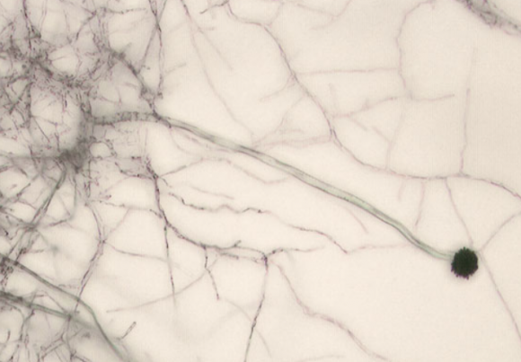 치명적 폐 질환을 일으키는 곰팡이인 ‘아스페르길루스 균류’. 위키피디아