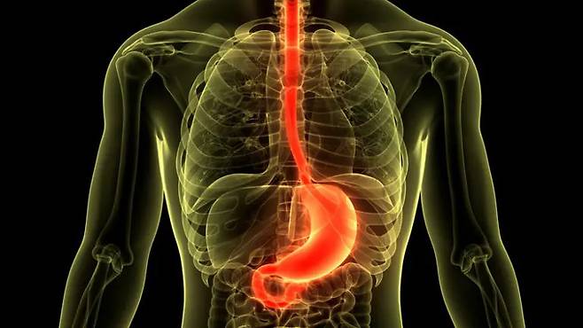 위내시경 검사를 받기 어려울 때 혈액검사로 위암 고위험군을 가려낼 수 있다는 연구 결과가 발표됐다. 게티이미지