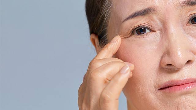 눈가 돌기는 비립종, 한관종 등 다양한 원인에 의해 나타날 수 있다｜출처: 게티이미지뱅크