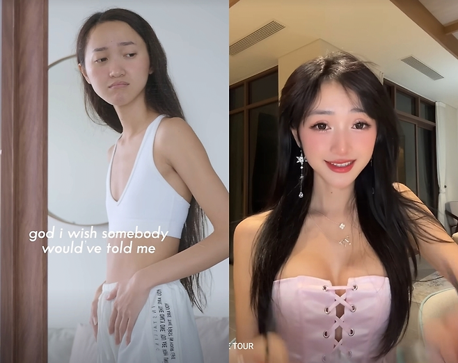 image.png “절벽 가슴도 사랑하자”던 420만 유튜버, 돌연 가슴 확대 수술