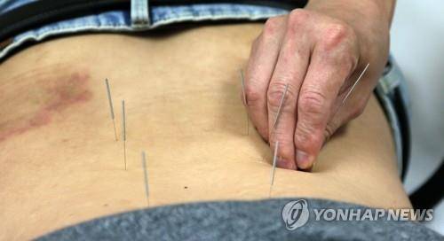침술  [연합뉴스 자료사진. 재판매 및 DB 금지]