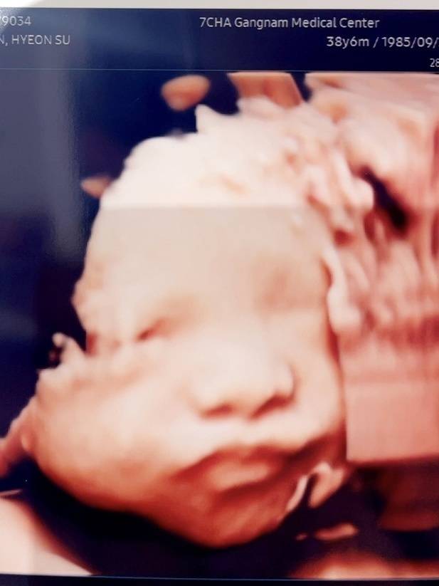 20여년 피운 담배를 끊게 만든 초음파 사진 나름대로 큰 결심을 한 행동이었다. 그런데 육아를 하다보니 금연보다 더 힘든 것들이 한두 가지가 아니었다. /사진=최우영 기자