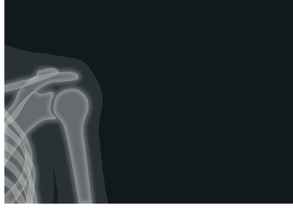 나이가 들수록 여기저기 아픈 곳은 늘어간다. 어깨도 그중 하나이다. [사진=픽사베이 @marcmanhart]