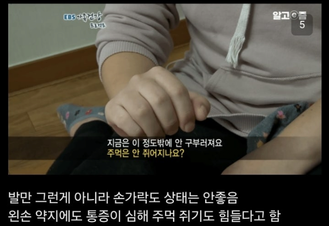 통풍 방치하면 안되는이유