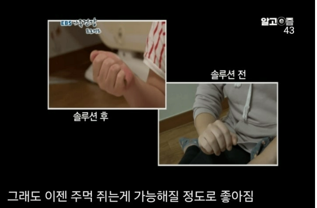 통풍 방치하면 안되는이유