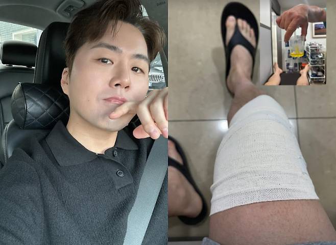 ‘태진아 子’ 이루, '음주 운전 자숙’ 중 근황 공개...“만신창이” (출처: 이루 인스타그램)