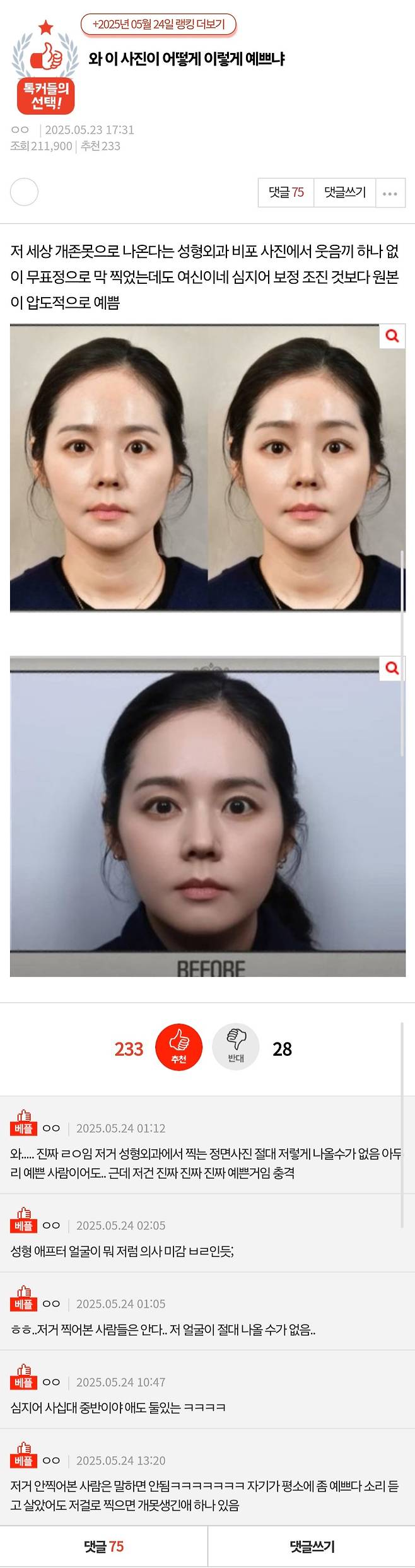 진짜 예쁘게 나오기 힘들다는 성형외과 정면 사진.jpg