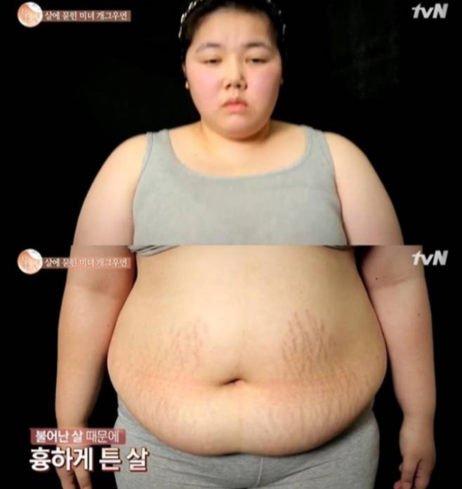 미녀 개그우먼으로 유명했던 개그우먼 한혜영이 임신 중독증 등으로 체중이 127㎏까지 쪘다고 고백한다. /사진=tvN '렛미인5'