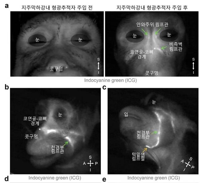 영장류에서 관찰된 뇌척수액 배출 림프관 분포. [자료=IBS]