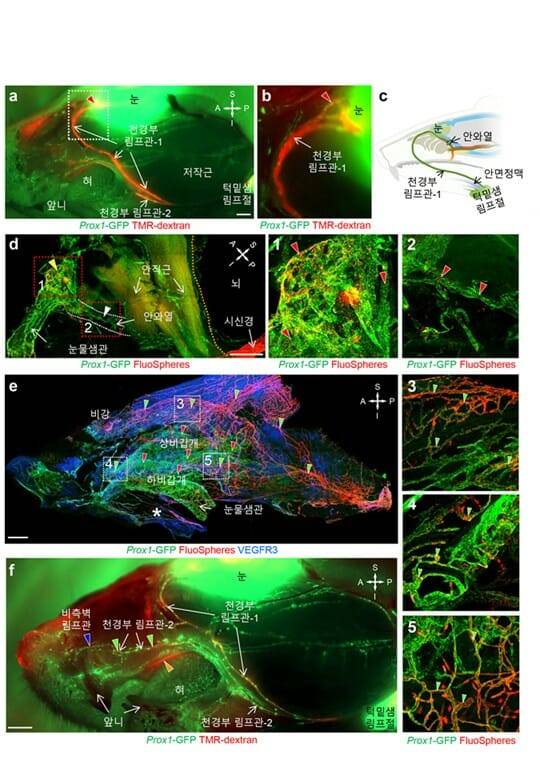 안와주위, 비강, 입천장 림프관을 통한 턱밑샘 림프절로의 뇌척수액 배출 경로를 나타낸 그림.