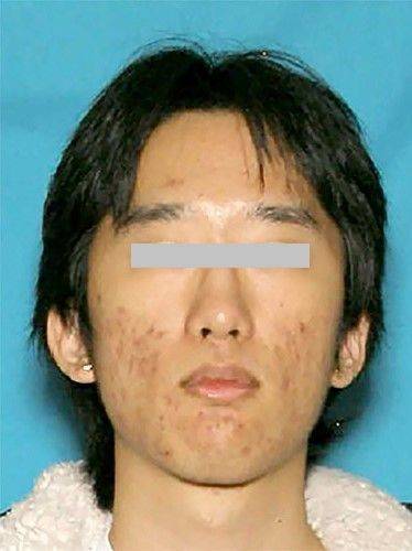 난임클리닉 테러 공범 대니얼 종연 박(32). FBI