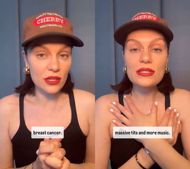 팝 가수 제시 제이가 4일(현지시간) 유방암 초기 진단을 받았다고 밝혔다. /AFPBBNews=뉴스1