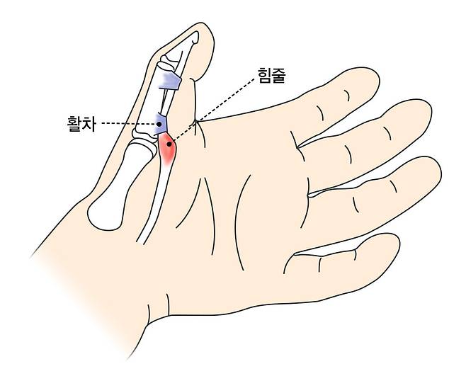 &copy;강동경희대병원 제공