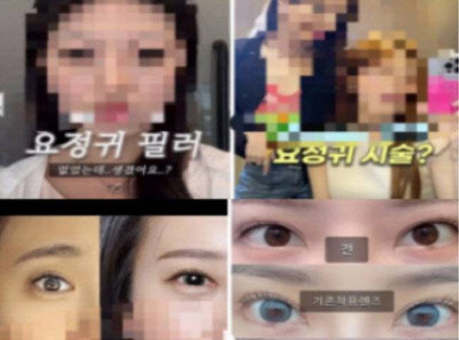 9일 SNS에 ‘요정귀 필러(왼쪽)’과 ‘아이링 수술’ 후기가 올라와 있다. (사진=인스타그램 갈무리)
