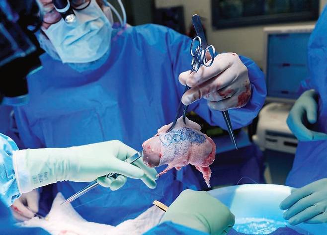 의사가 이식 수술 도중에 면역거부반응이 없도록 유전자 편집을 거친 돼지 신장을 들고 있다./미국 뉴욕대 랑곤 의료센터