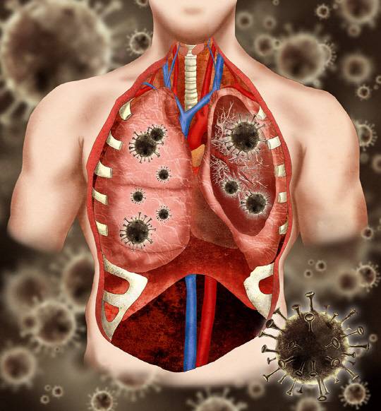 박우람 성균관대 교수 연구팀은 미국 연구진과 공동으로 코로나19 감염에 따른 폐 손상을 억제할 수 있는 나노약물전달기술을 개발했다. 아이클릭아트 제공