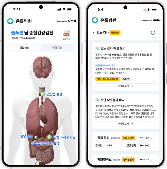 병원용 AI 의료 데이터 서비스 '온톨 클리닉'(사진=테서)