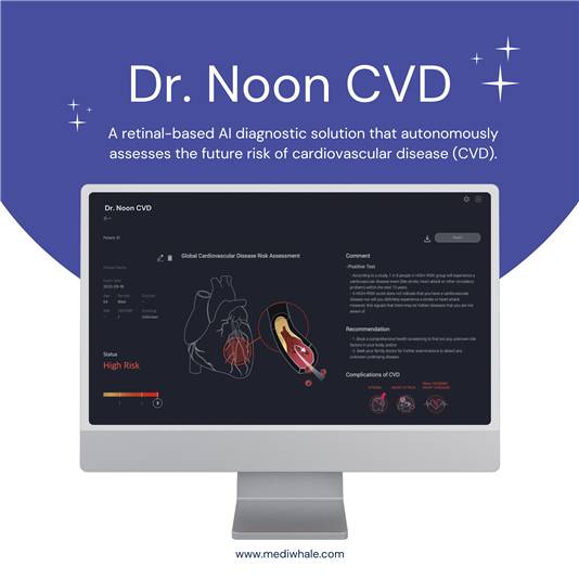 닥터눈 CKD AI 소프트웨어 화면