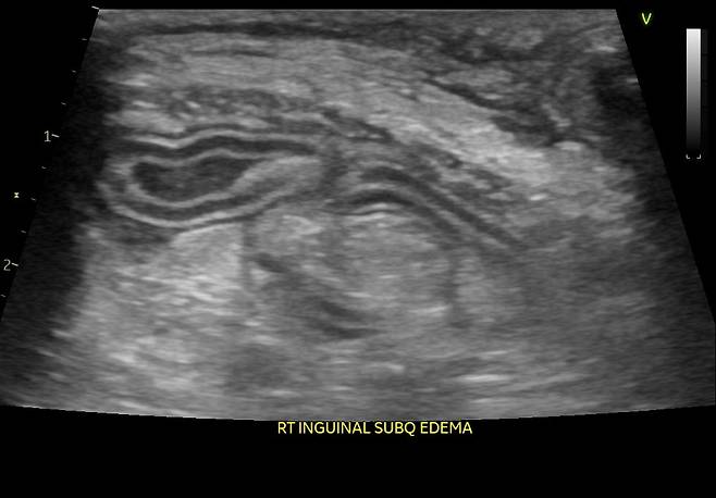 us0037.jpg 강아지 중성화 건강때문에도한다